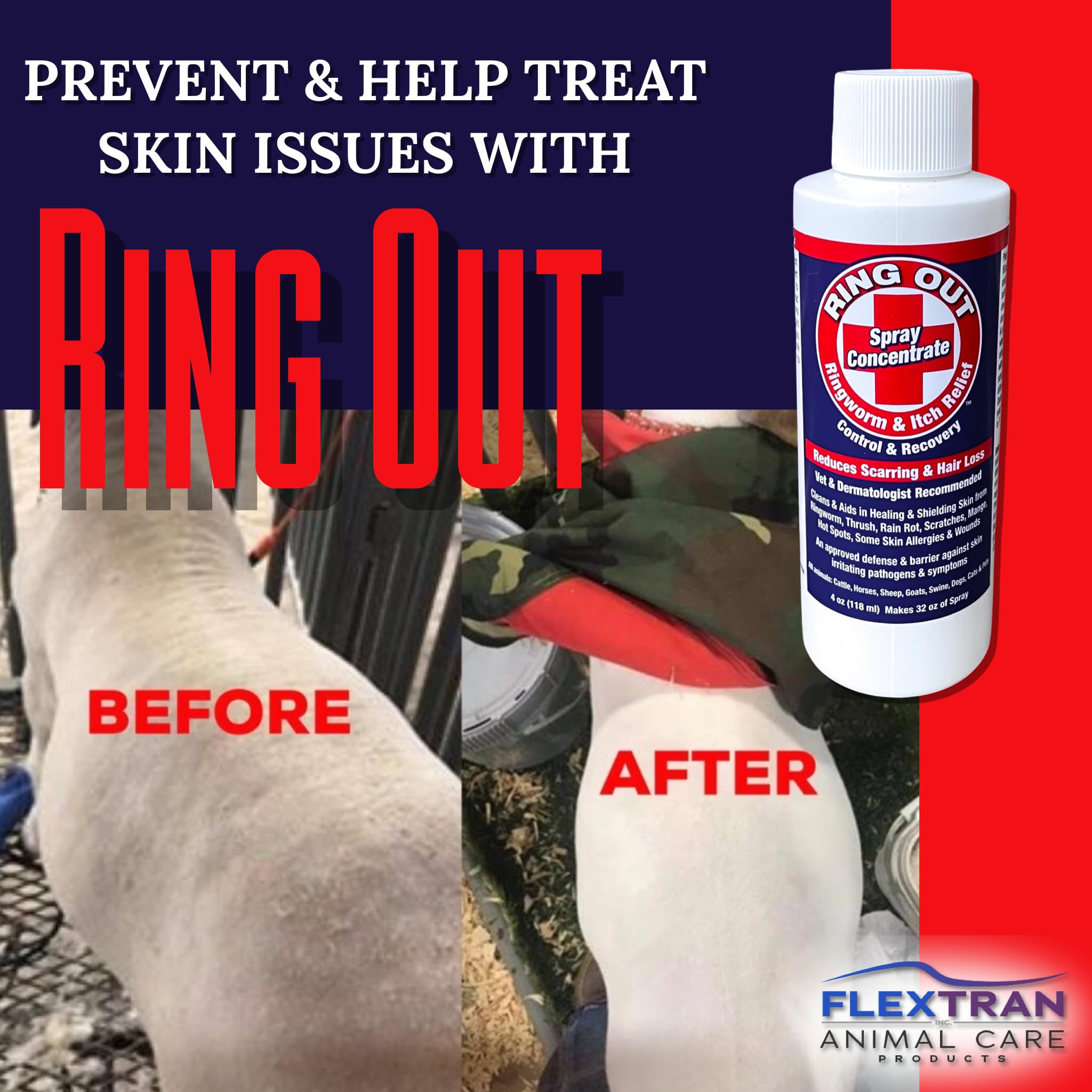 FlexTran RingOut Produit Topique, application facile lors des soins réguliers.