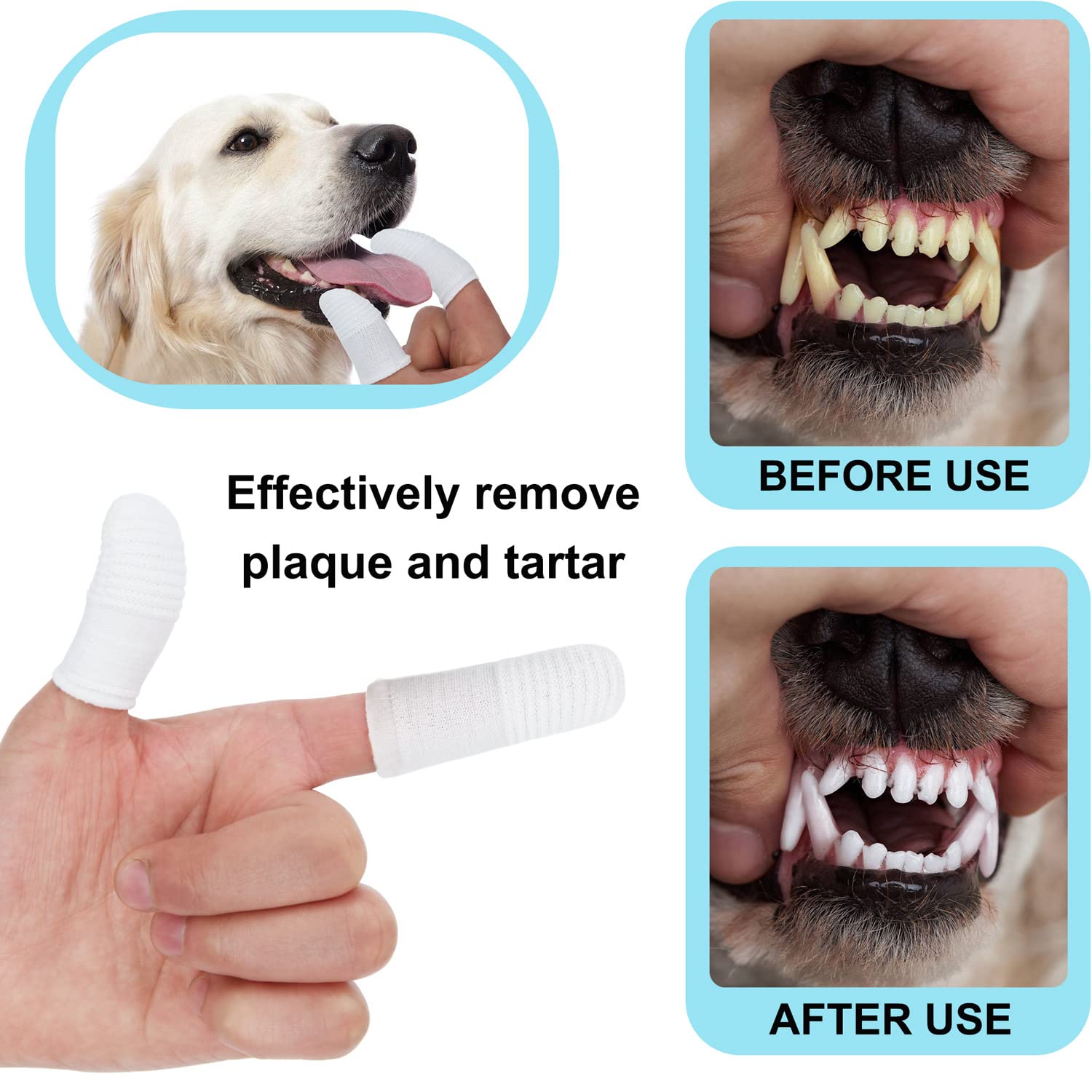 PenVinoo brosse-doigts polyvalente, nettoie les dents dans toutes les directions.