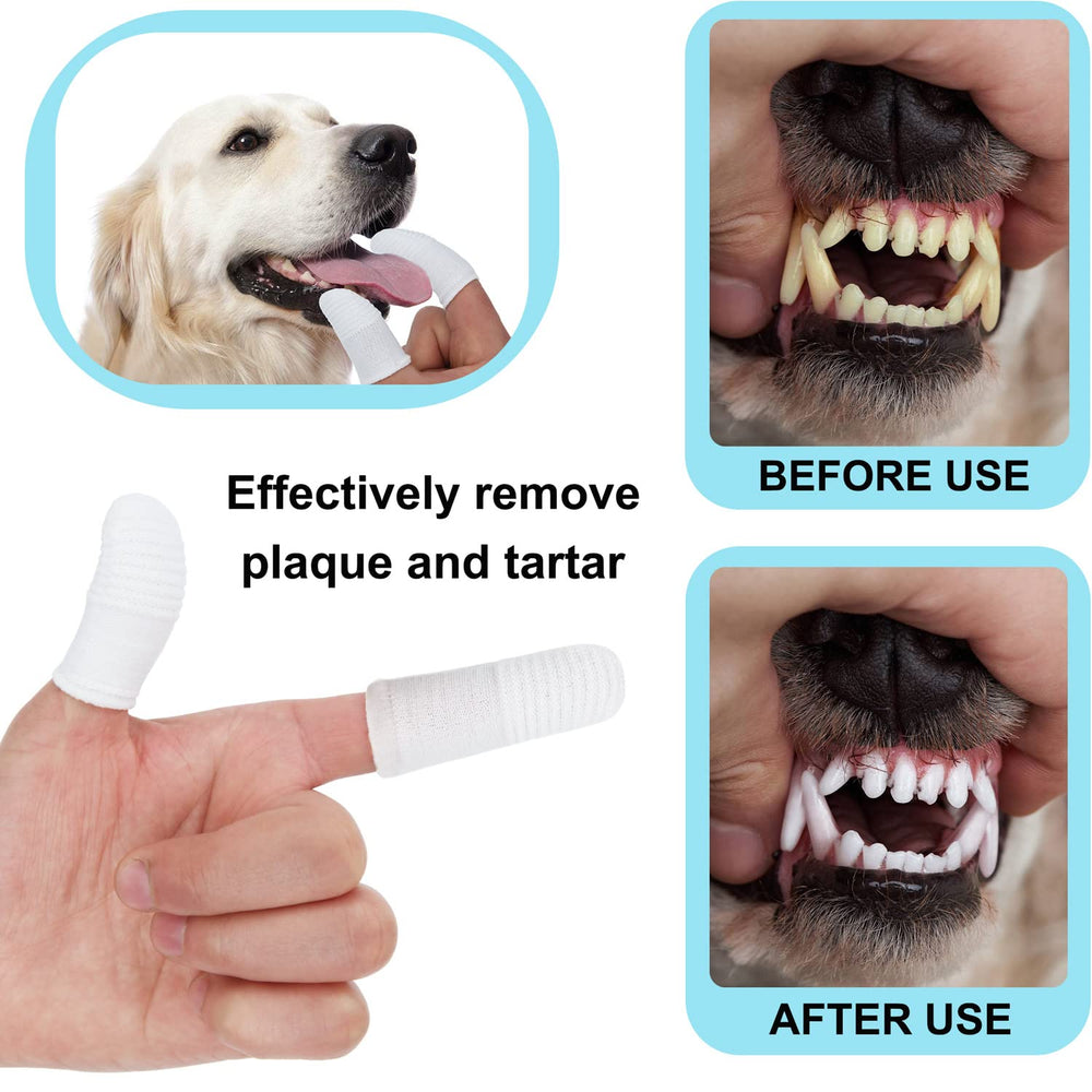 PenVinoo brosse-doigts polyvalente, nettoie les dents dans toutes les directions.