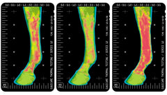Vita Flex Thermaflex Gel – stimulation de la circulation, chaleur longue durée.